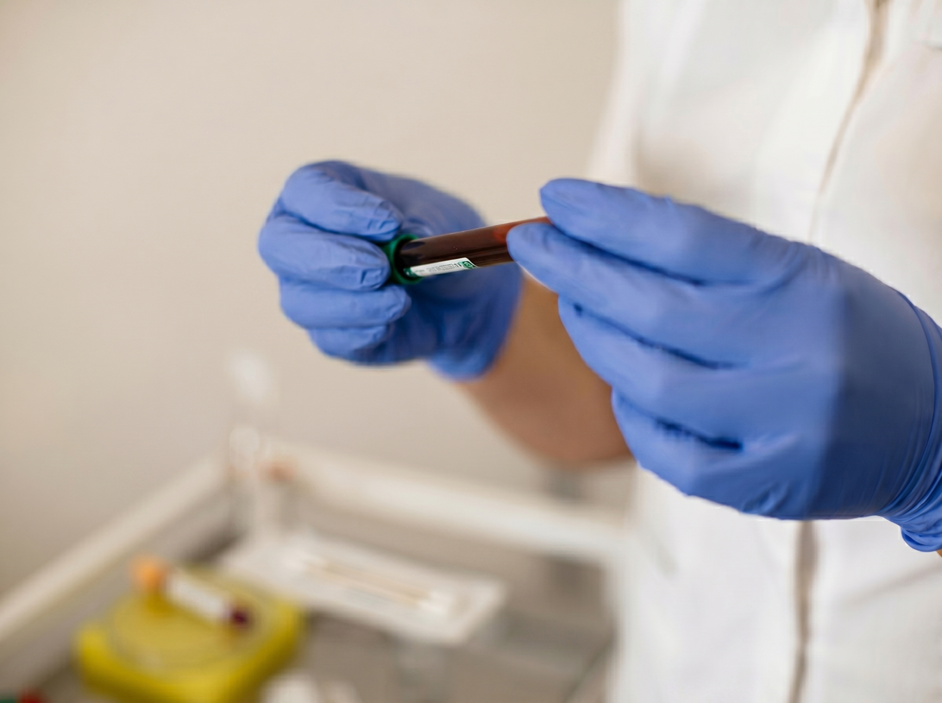 Coleta de sangue para exames laboratoriais de colesterol