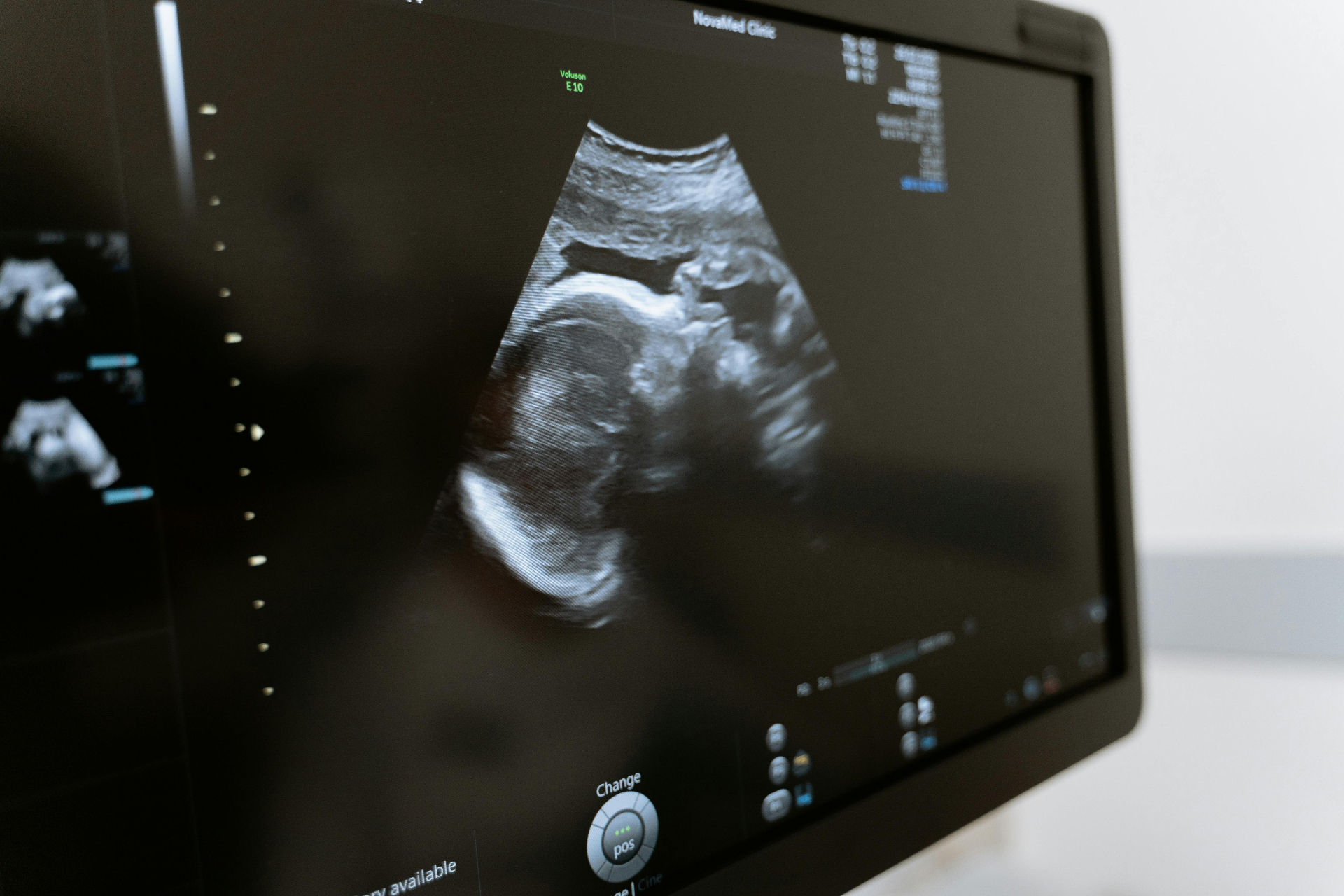 Etapa da consulta cardiológica: Ultrassom cardíaco focado (FOCUS)